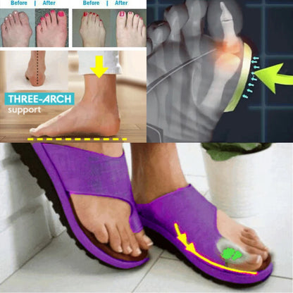 Rongkun Orthopedic Big Toe Sandals